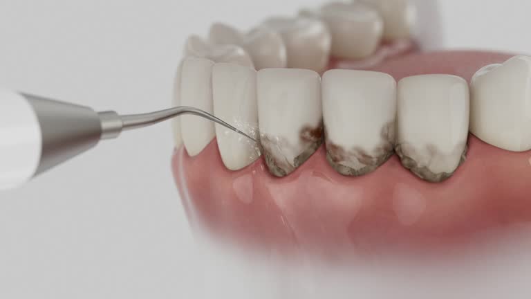 Reliable Dental Implants contractor in Magnolia, TX by Smile Center Dentistry